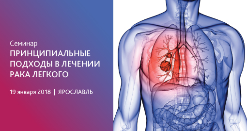 Семинар «Принципиальные подходы в лечении рака легкого» (19 января 2018, Ярославль)