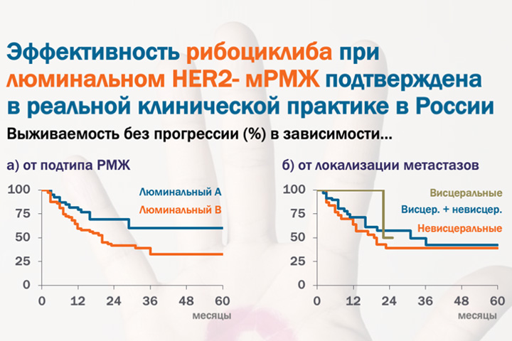 Результаты применения рибоциклиба в реальной клинической практике в России